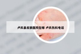 卢氏县皮肤医院在哪 卢氏伤科电话