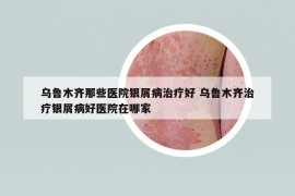 乌鲁木齐那些医院银屑病治疗好 乌鲁木齐治疗银屑病好医院在哪家