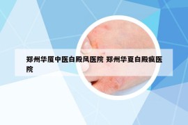 郑州华厦中医白殿风医院 郑州华夏白殿疯医院