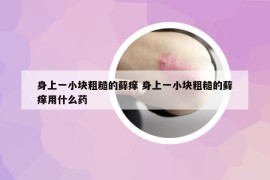身上一小块粗糙的藓痒 身上一小块粗糙的藓痒用什么药