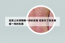 后背上长得跟癣一样的东西 后背长了很多像癣一样的东西