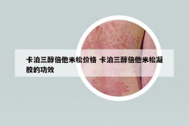 卡泊三醇倍他米松价格 卡泊三醇倍他米松凝胶的功效