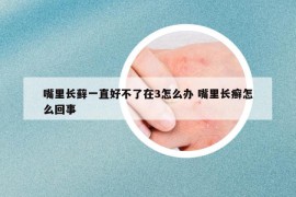 嘴里长藓一直好不了在3怎么办 嘴里长癣怎么回事