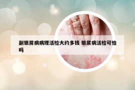 副银屑病病理活检大约多钱 银屑病活检可怕吗