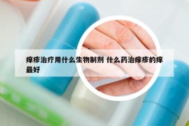 痒疹治疗用什么生物制剂 什么药治痒疹的痒最好