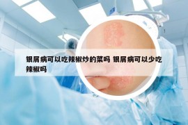 银屑病可以吃辣椒炒的菜吗 银屑病可以少吃辣椒吗