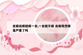 皮癣说痒就痒一会,一会就不痒 皮癣突然痒是严重了吗