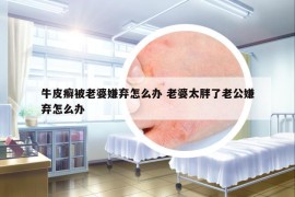 牛皮癣被老婆嫌弃怎么办 老婆太胖了老公嫌弃怎么办