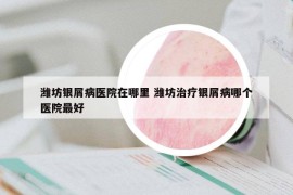潍坊银屑病医院在哪里 潍坊治疗银屑病哪个医院最好