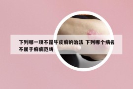 下列哪一项不是牛皮癣的治法 下列哪个病名不属于癣病范畴