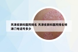 天津皮肤科医院排名 天津皮肤科医院排名榜津门电话号多少