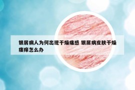 银屑病人为何出现干燥痛感 银屑病皮肤干燥瘙痒怎么办
