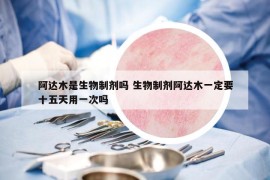 阿达木是生物制剂吗 生物制剂阿达木一定要十五天用一次吗