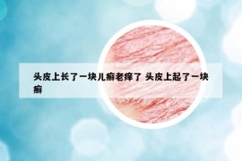 头皮上长了一块儿癣老痒了 头皮上起了一块癣