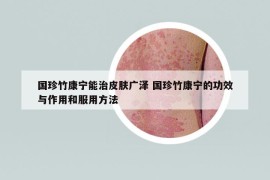 国珍竹康宁能治皮肤广泽 国珍竹康宁的功效与作用和服用方法