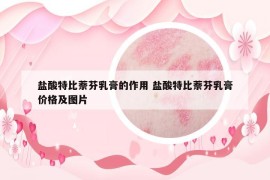 盐酸特比萘芬乳膏的作用 盐酸特比萘芬乳膏价格及图片