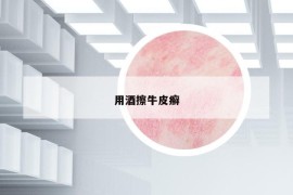 用酒擦牛皮癣