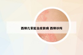 西柳几家能治皮肤病 西柳诊所
