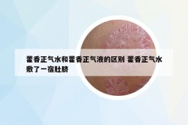 藿香正气水和藿香正气液的区别 藿香正气水敷了一宿肚脐