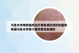 乌鲁木齐哪些医院治疗银屑病比较好的医院 新疆乌鲁木齐哪个医院看皮肤病好