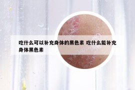吃什么可以补充身体的黑色素 吃什么能补充身体黑色素
