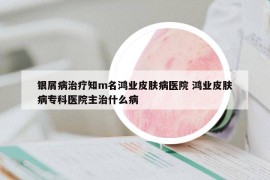 银屑病治疗知m名鸿业皮肤病医院 鸿业皮肤病专科医院主治什么病