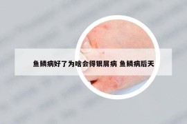 鱼鳞病好了为啥会得银屑病 鱼鳞病后天