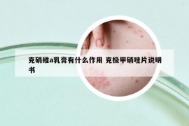 克硝维a乳膏有什么作用 克极甲硝唑片说明书