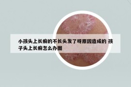 小孩头上长癣的不长头发了呀原因造成的 孩子头上长癣怎么办图