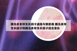 胰岛素素样生长因子通路与银屑病 胰岛素样生长因子和胰岛素样生长因子结合蛋白