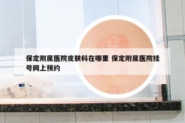 保定附属医院皮肤科在哪里 保定附属医院挂号网上预约