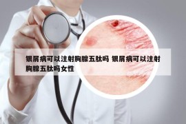 银屑病可以注射胸腺五肽吗 银屑病可以注射胸腺五肽吗女性