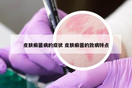 皮肤癣菌病的症状 皮肤癣菌的致病特点