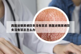 西医说银屑病饮食没有禁忌 西医说银屑病饮食没有禁忌怎么办