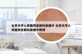 北京大学人民医院皮肤科张建中 北京大学人民医院皮肤科张建中教授