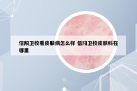 信阳卫校看皮肤病怎么样 信阳卫校皮肤科在哪里