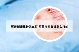 可善挺密集针怎么打 可善挺密集针怎么打的