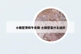 小肠壁薄和牛皮癣 小肠壁是什么组织
