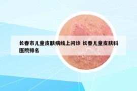 长春市儿童皮肤病线上问诊 长春儿童皮肤科医院排名