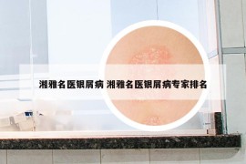 湘雅名医银屑病 湘雅名医银屑病专家排名