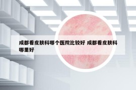 成都看皮肤科哪个医院比较好 成都看皮肤科哪里好