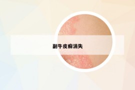 副牛皮癣消失