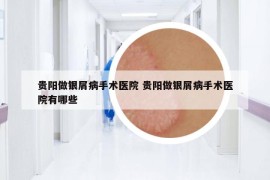 贵阳做银屑病手术医院 贵阳做银屑病手术医院有哪些