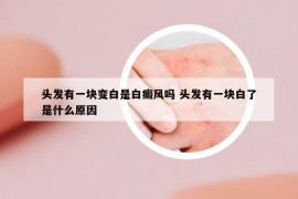 头发有一块变白是白癜风吗 头发有一块白了是什么原因