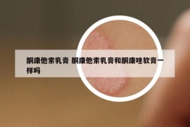 酮康他索乳膏 酮康他索乳膏和酮康唑软膏一样吗