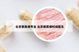 北京银屑病专治 北京银屑病权威医生