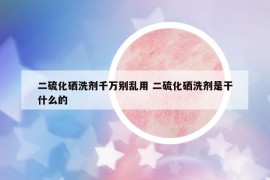 二硫化硒洗剂千万别乱用 二硫化硒洗剂是干什么的