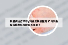 银屑病治疗举荐y鸿业皮肤病医院 广州鸿业皮肤病专科医院搬去哪里了