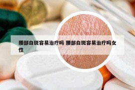 腰部白斑容易治疗吗 腰部白斑容易治疗吗女性