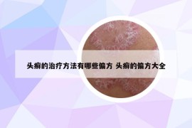 头癣的治疗方法有哪些偏方 头癣的偏方大全